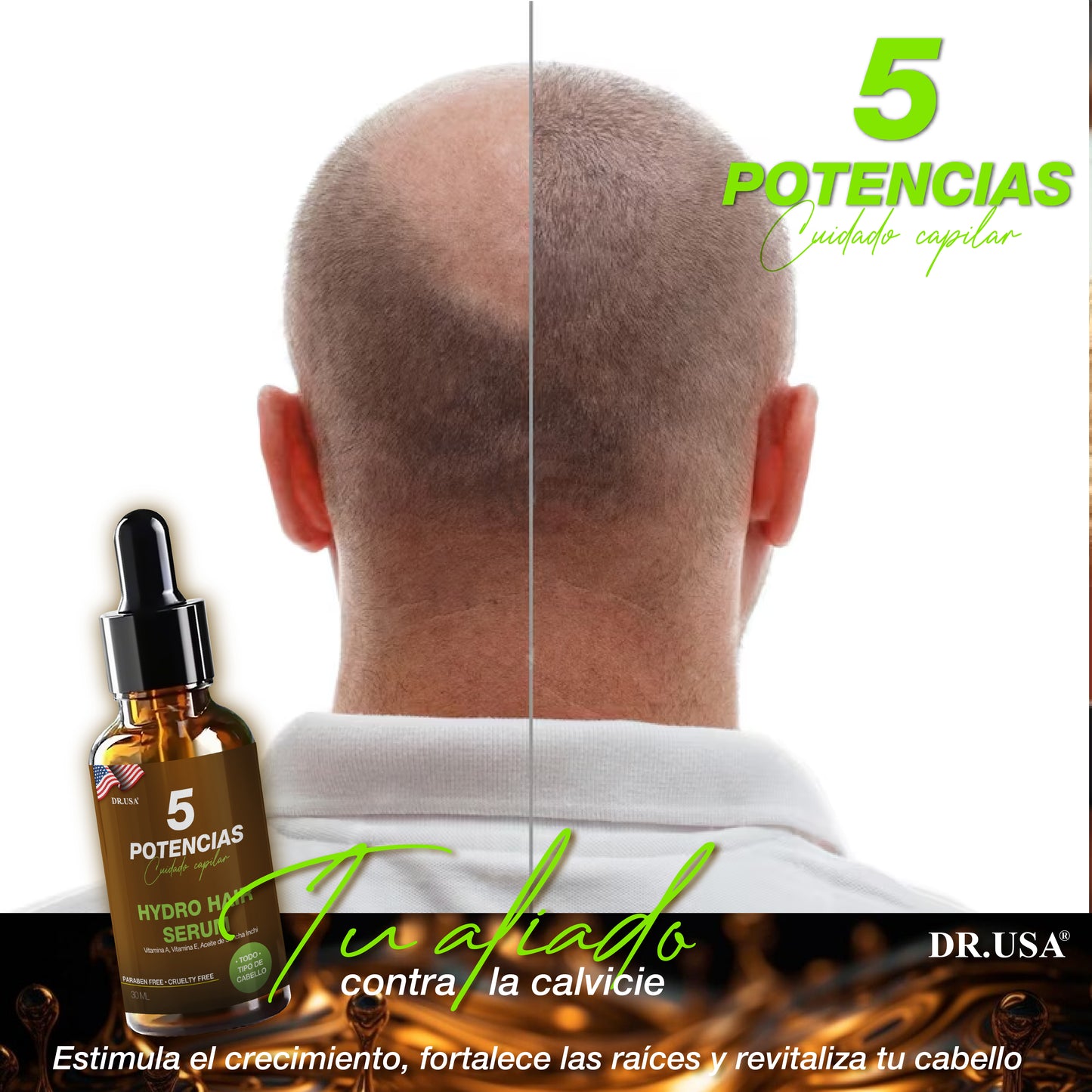 SERUM 5 POTENCIAS ANTICAIDA DE CABELLO